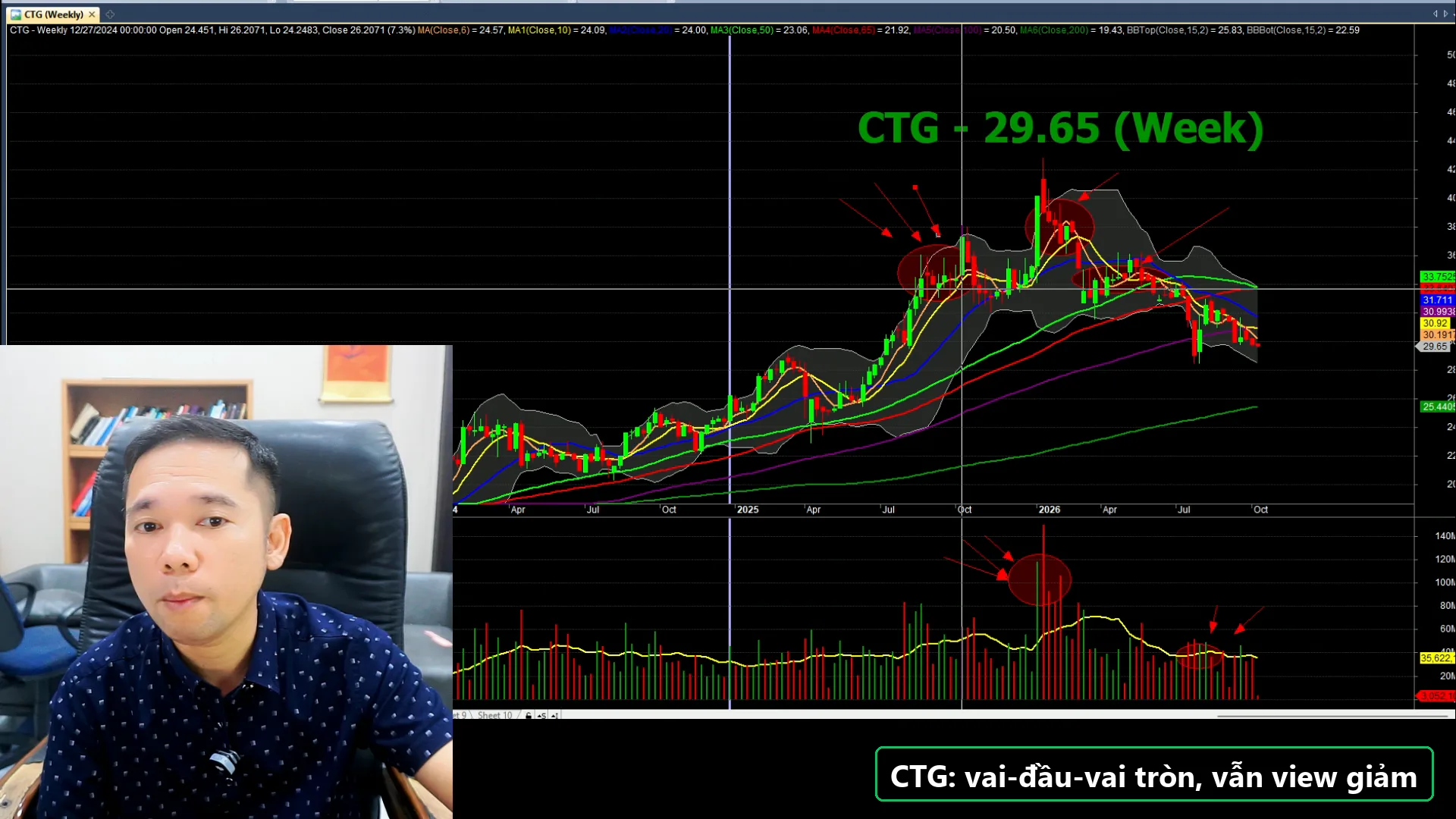 Biểu đồ phân tích CTG - livestream 05/10/2026